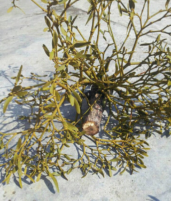 刮痧治疗脂溢性脱发