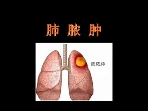 枸杞玉米排骨汤